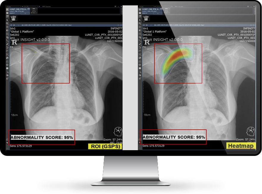 Medical software INFINITT North America radiology / image analysis