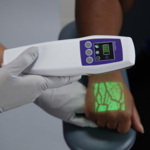 LED vein finder - AV500 - AccuVein - venipuncture / digital / hand-held