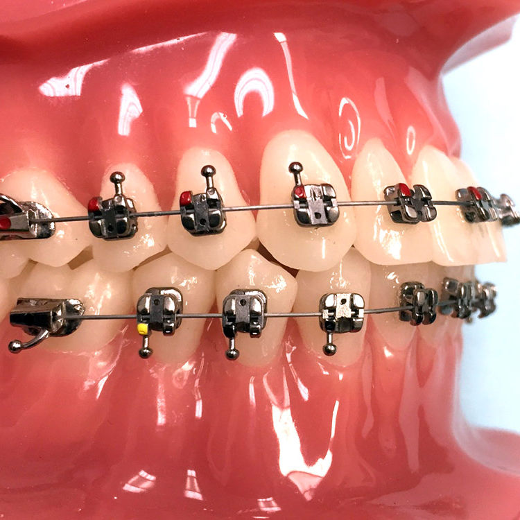 Metal orthodontic bracket Agility® G&H Orthodontics selfligating
