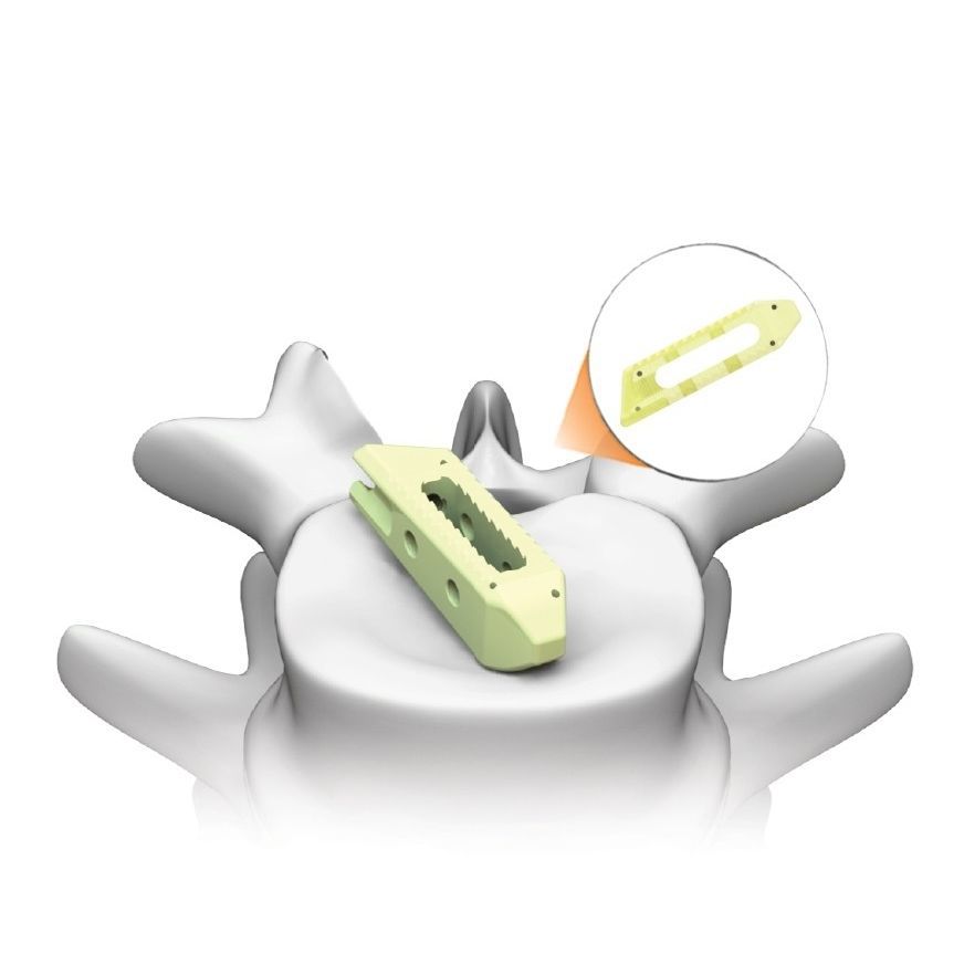 Lumbar interbody fusion cage PLATEAU®LO Life Spine