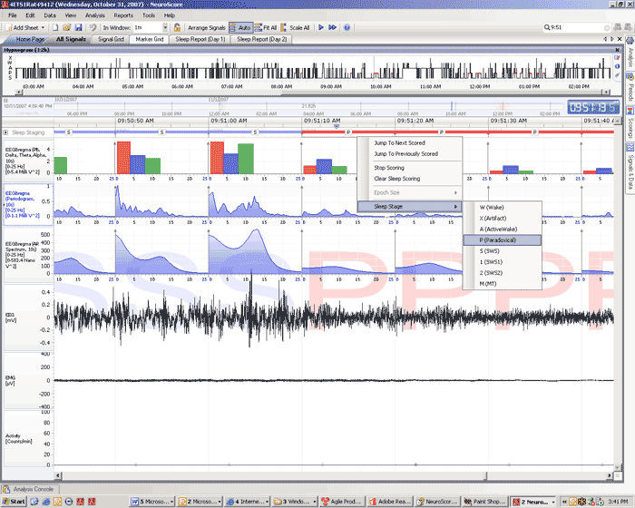 Neurophysiological stimulation software NeuroScore DSI for animal