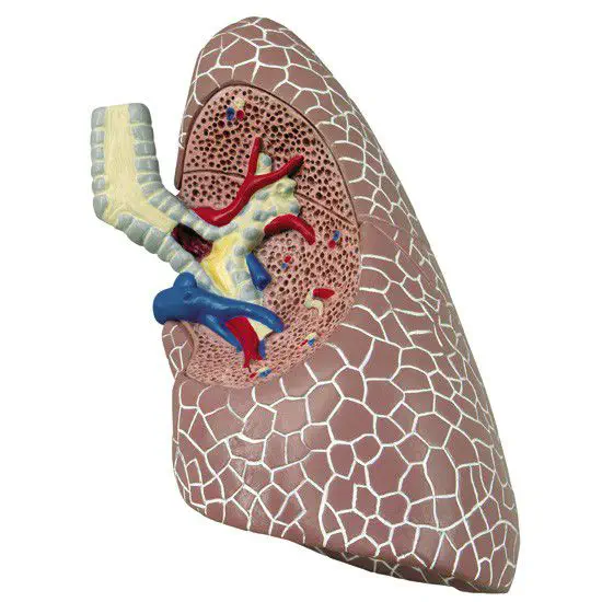 Modello Anatomico Malato Bronchus GPI LFA #3120 | 4 Pezzi Con Video