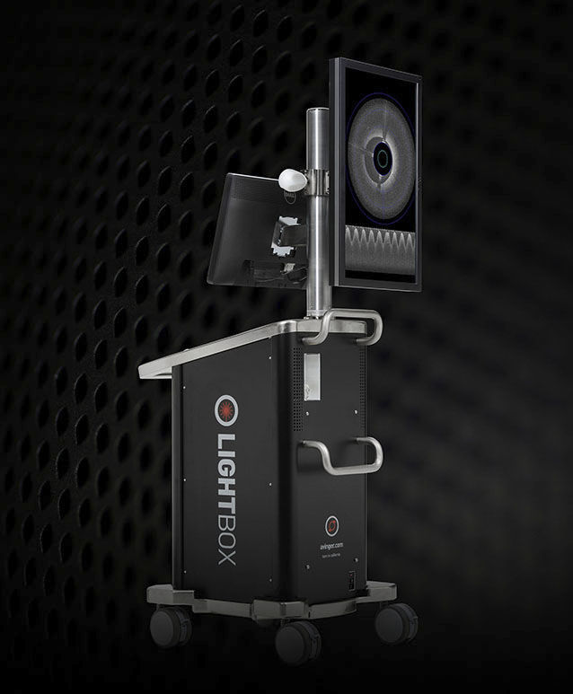OCT endoscopic imaging system Lightbox Avinger intravascular imaging