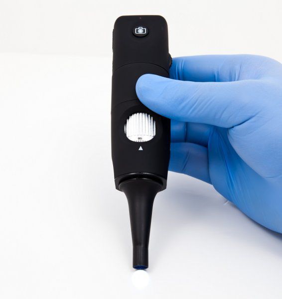 firefly otoscope price