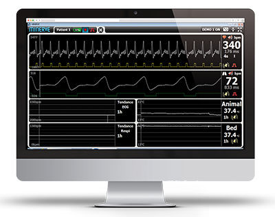 Laboratory biosignal acquisition system - PHYSIOGUARD II - MINERVE ...