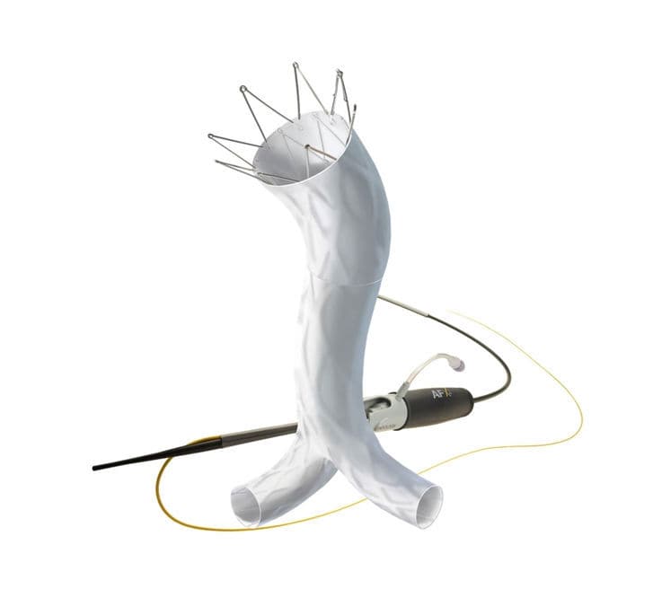 Abdominal aorta stent graft AFX® Endologix ePTFE
