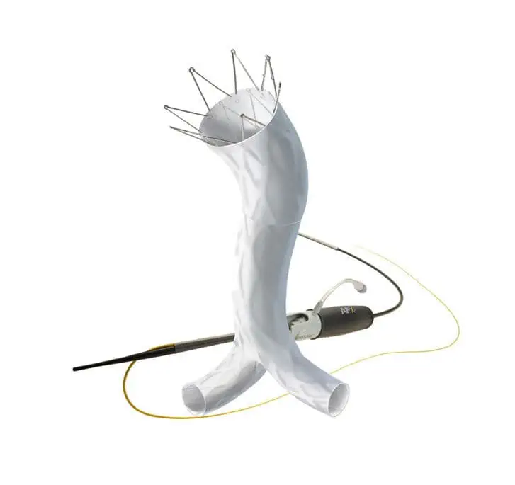 Abdominal aorta stent graft - AFX - Endologix - ePTFE