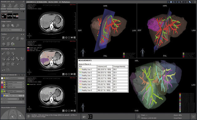 Analysis software module - Myrian® XP-Liver - Intrasense ...