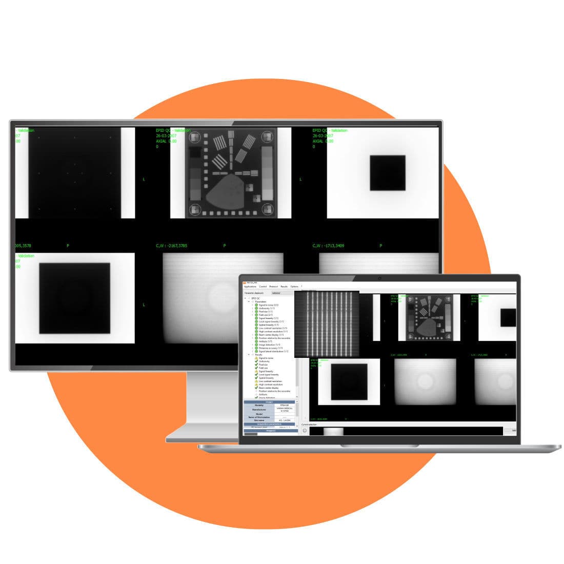 Diagnostic Management System Epid QA AQUILAB Signal For diagnostic-management-system-epid-qa-aquilab-signal-for