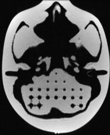 Radiosurgery test phantom - 603-GS - CIRS - for MRI / skull