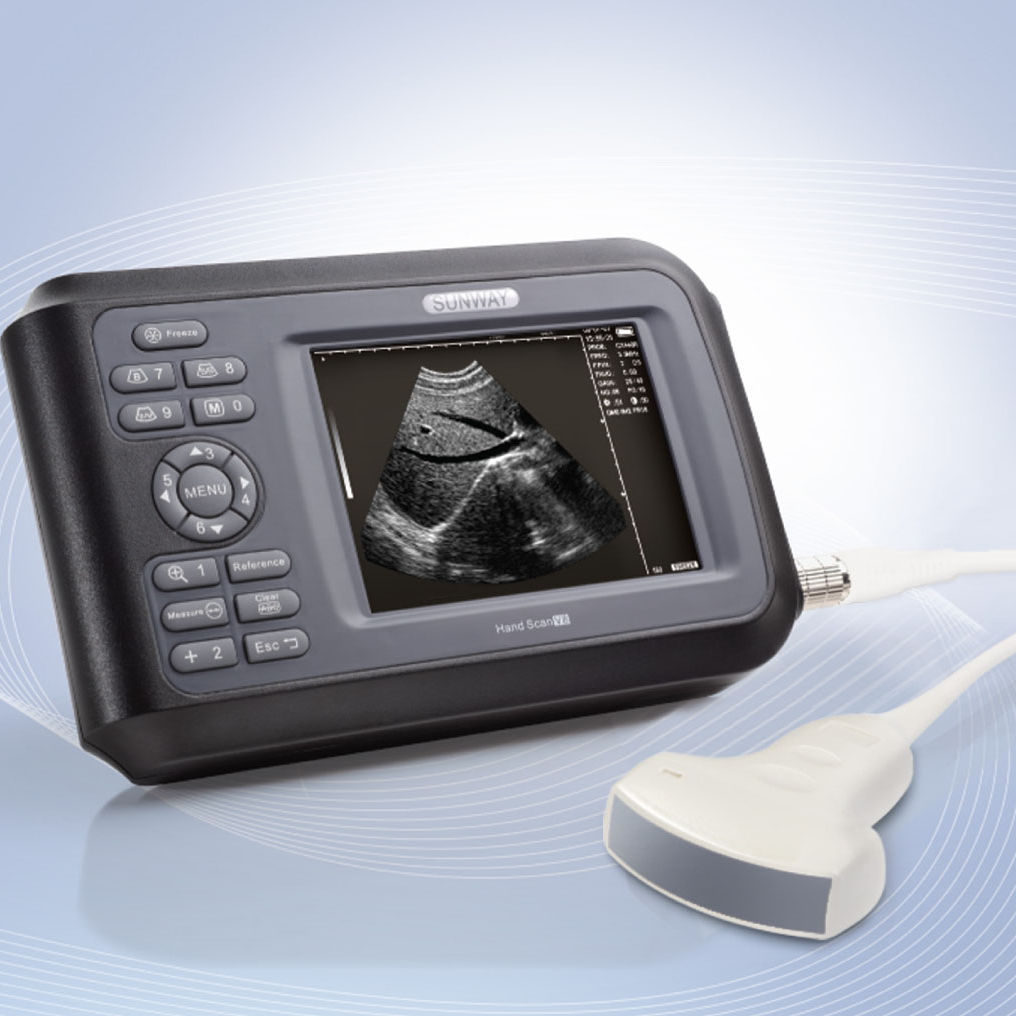 Handheld ultrasound system Handscan H8 Sunway Medical for