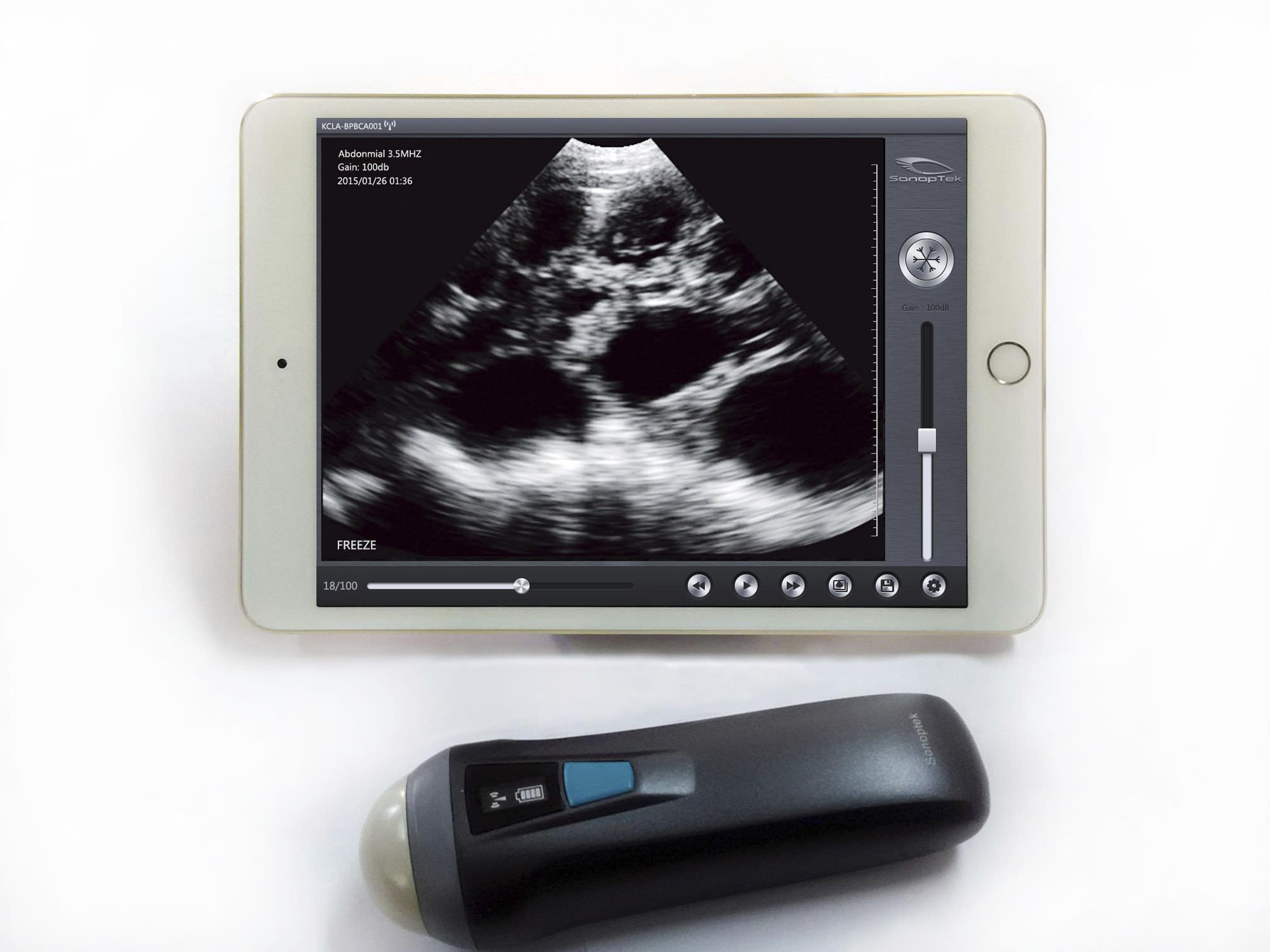 Hand-held Veterinary Ultrasound System - SV-1 - SonicVet - Multipurpose