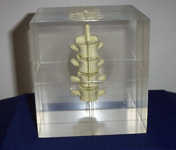 Radiography test phantom - RS-1400 - Radiology Support Devices - spine