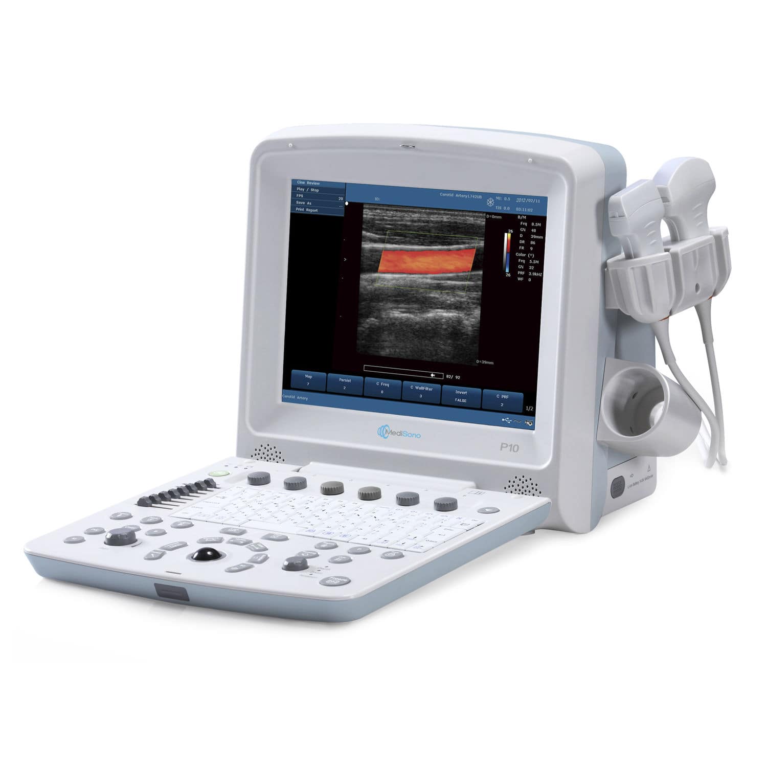 Portable ultrasound system P10 MediSono for multipurpose