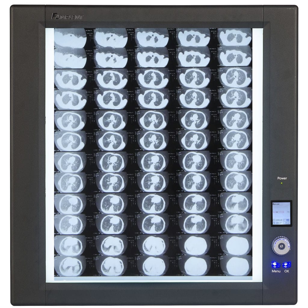 Digital Xray film viewer Trimline Wolf XRay Corporation 1