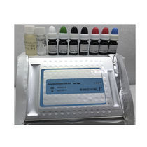 Colorimetric test kit, Colorimetric assay kit - All medical device ...