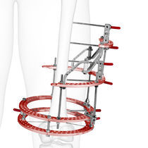 External fixation system - All medical device manufacturers