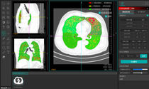 Neusoft Medical Systems : Medical Imaging - MedicalExpo