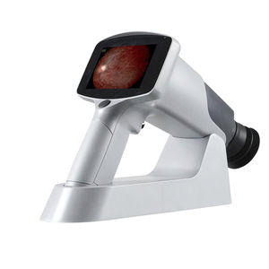 non-mydriatic retinal camera