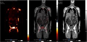 CT software