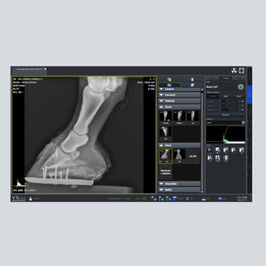 radiography software