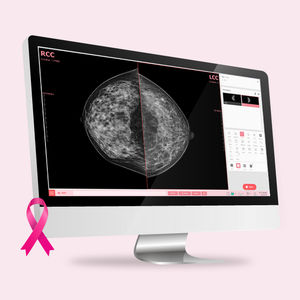 mammography software