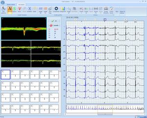 cardiac Holter monitor software