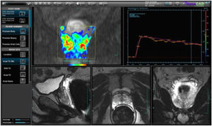 MRI software