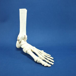joint model