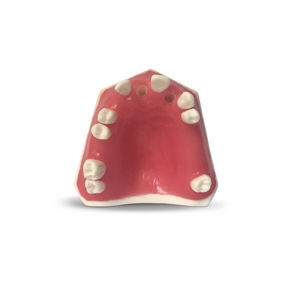 gingival model 1