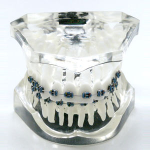 denture model