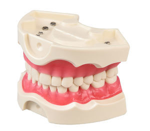 tooth model 1