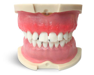 tooth model 1