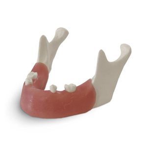mandible model 1