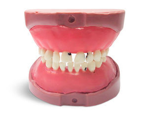 tooth model 1