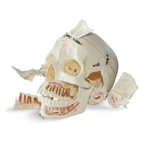 skull model 1