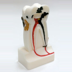 tooth model 1