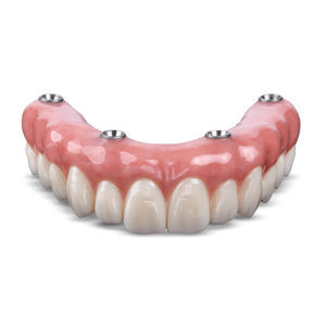 zirconia dental prosthesis