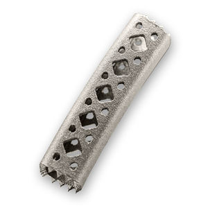 cervical vertebral corpectomy prosthesis