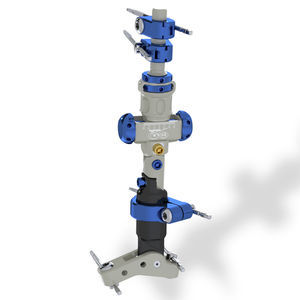 ankle external fixation system