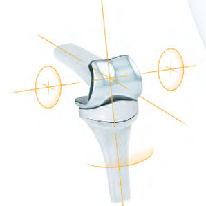 interphalangeal hand joint implant