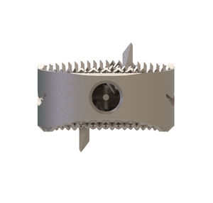 cervical interbody fusion cage 1