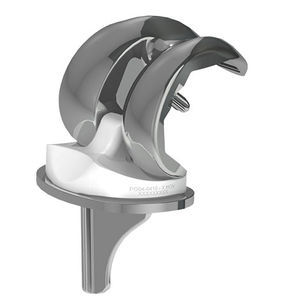 mobile-bearing knee prosthesis / cemented or non-cemented