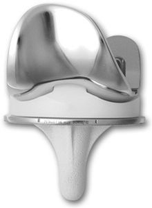 three-compartment knee prosthesis