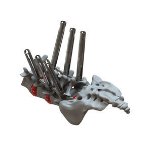 minimally invasive pedicle screw positioning system