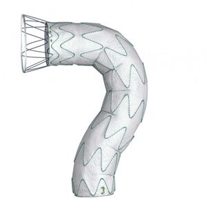 descending thoracic aorta stent graft