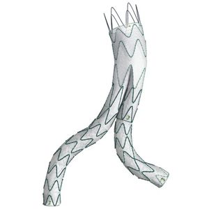 abdominal aorta stent graft