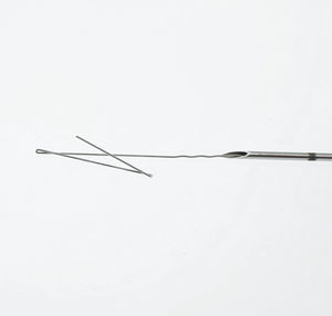breast localization needle 1