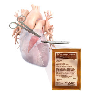 cardiac tissue matrix
