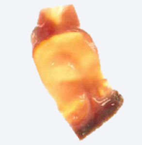 cardiac tissue matrix